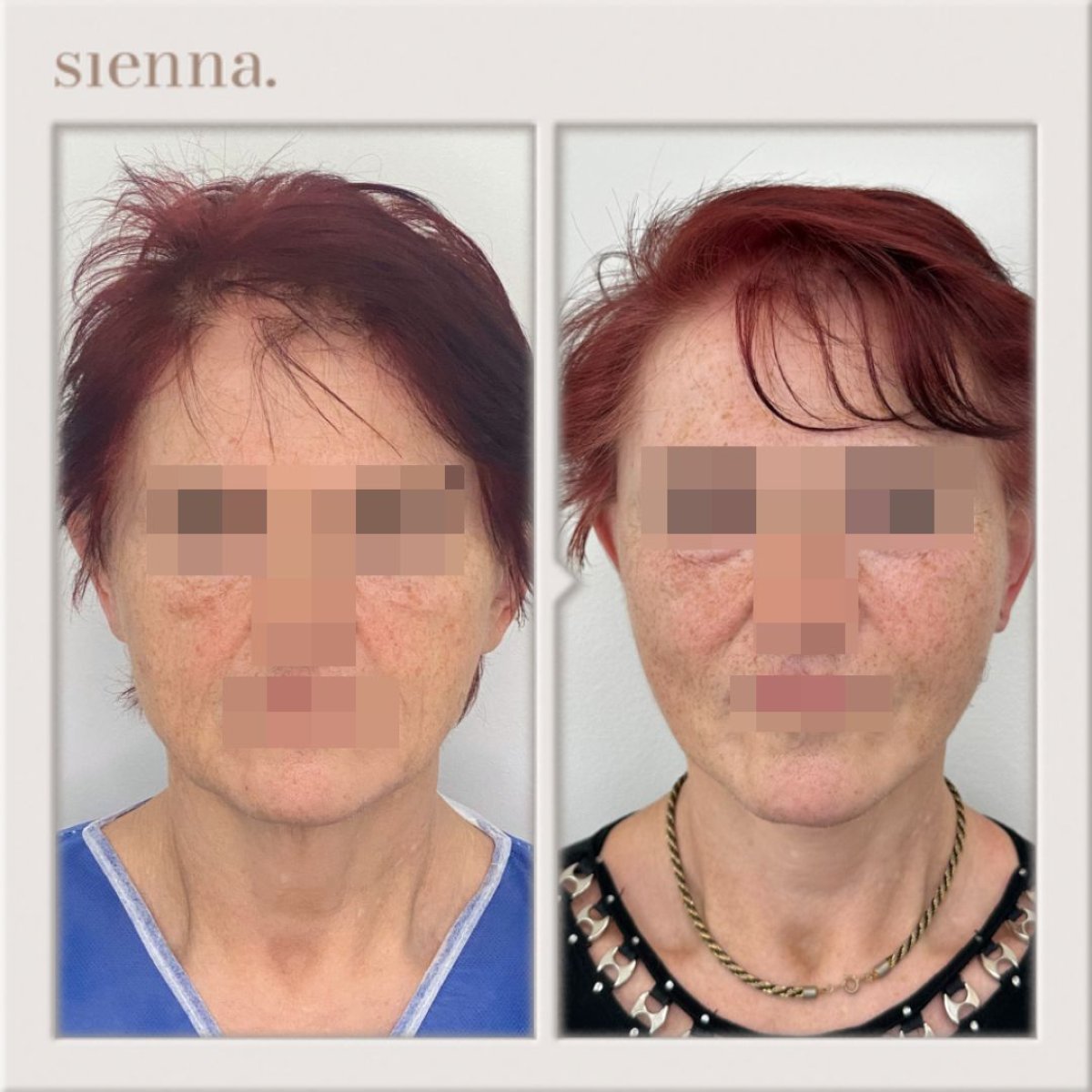 before and after photo