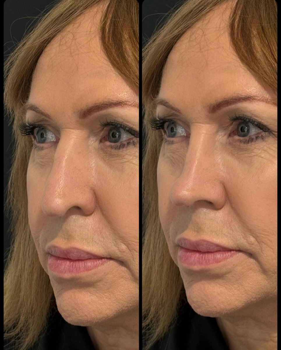 before and after photo