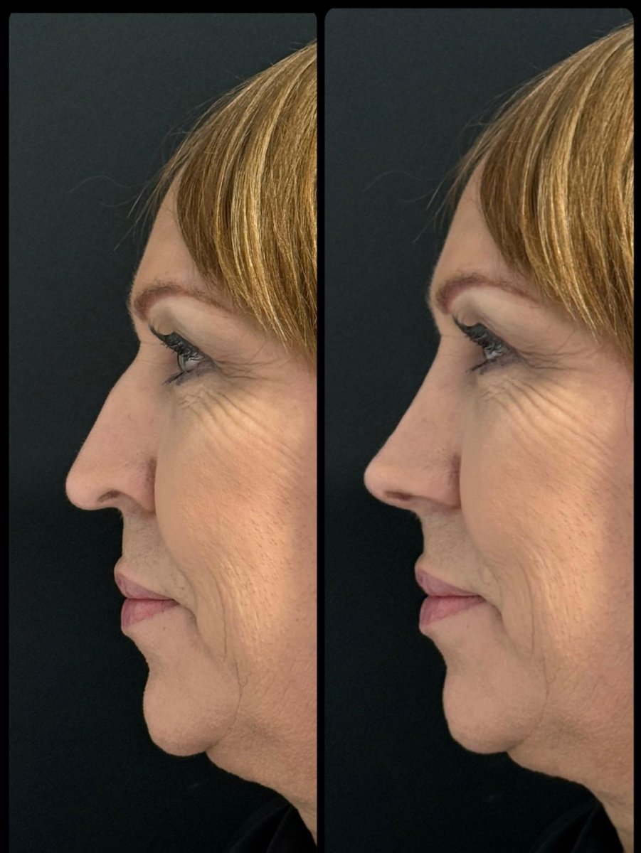 before and after photo