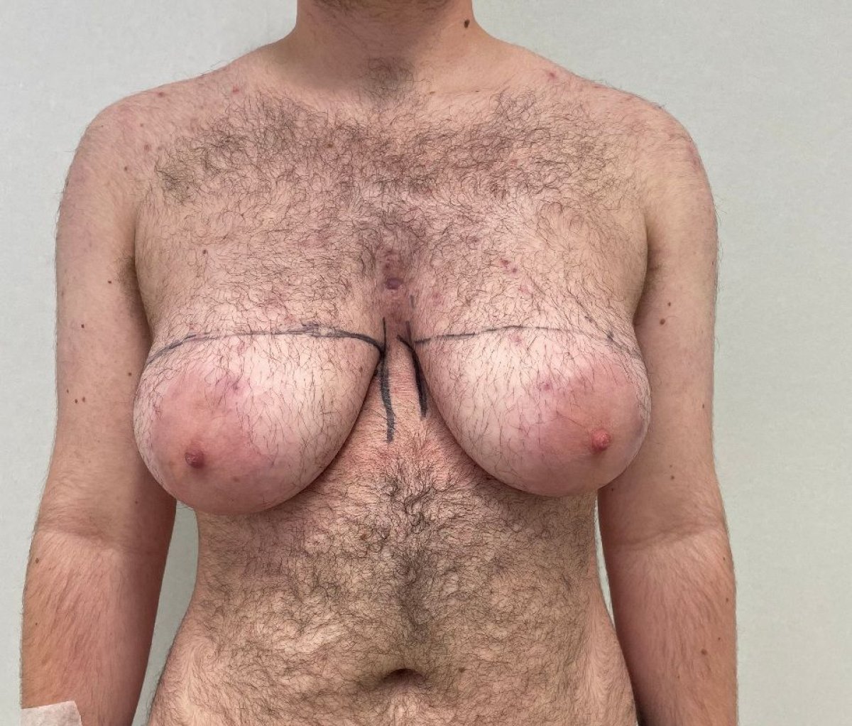 before and after photo
