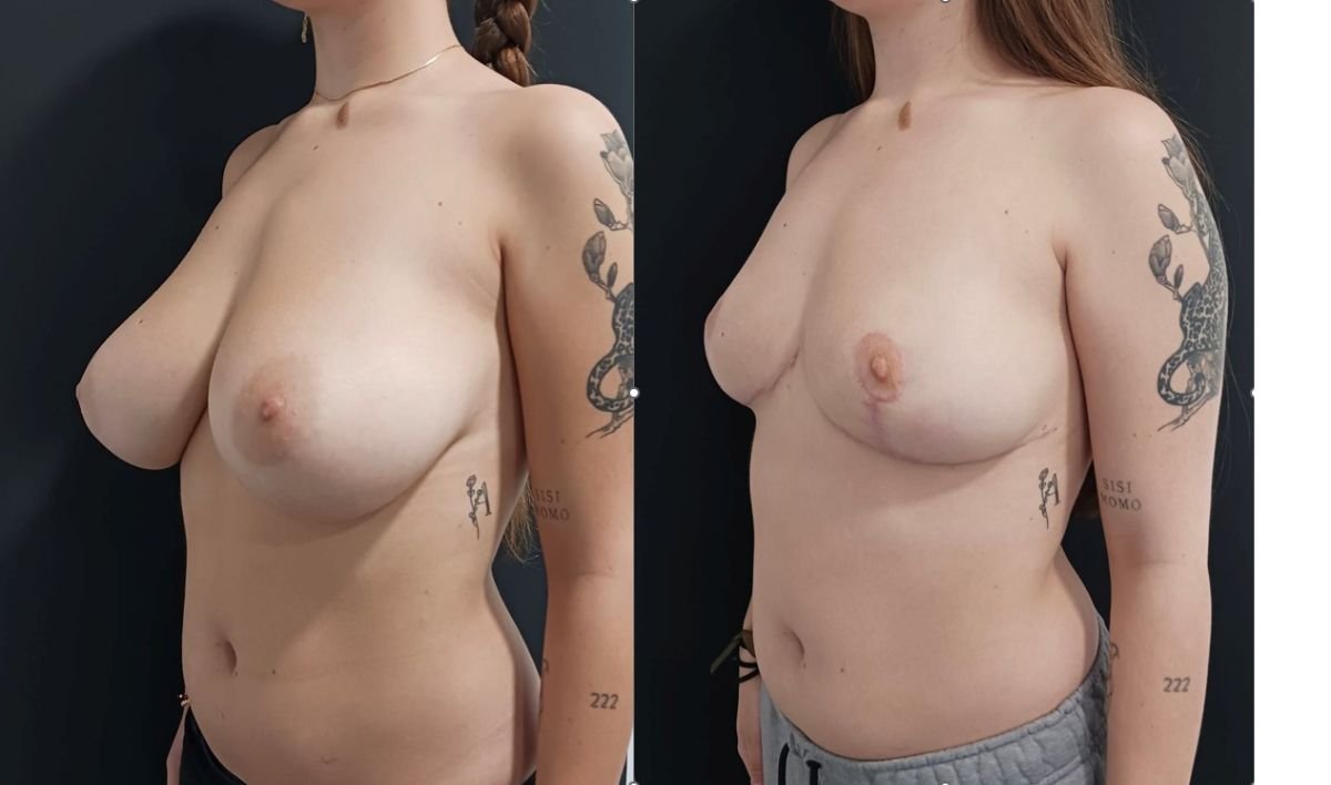 before and after photo