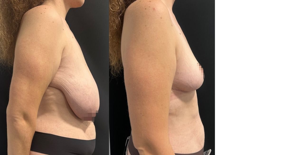 before and after photo