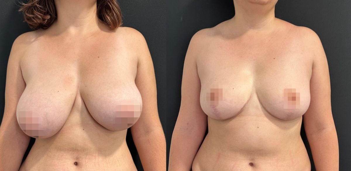 before and after photo