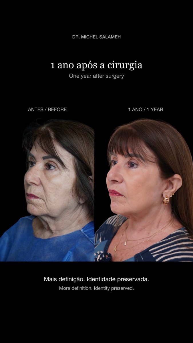 before and after photo