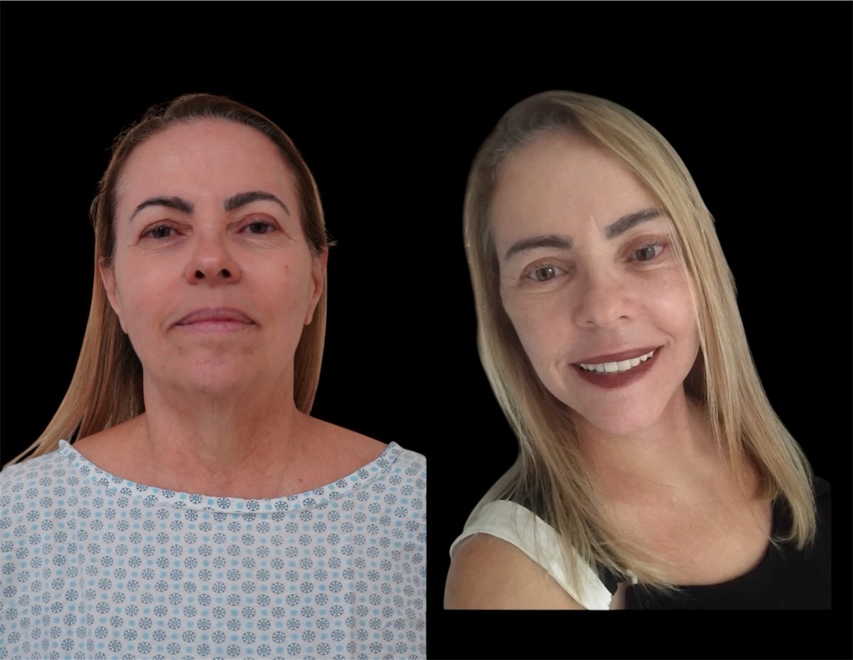 before and after photo