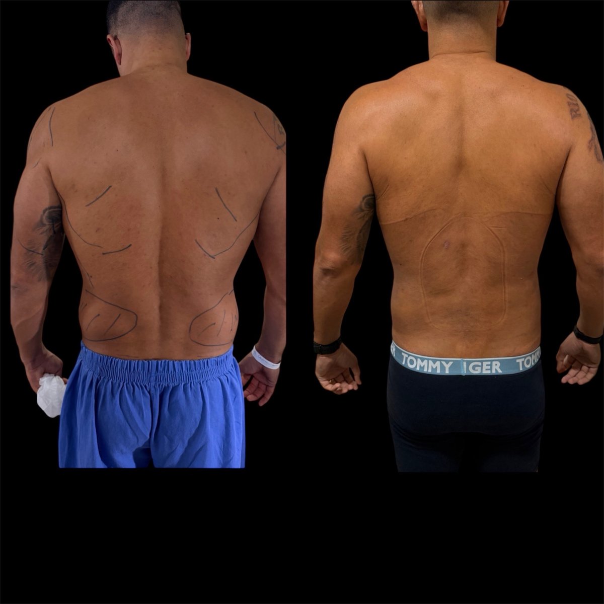 before and after photo