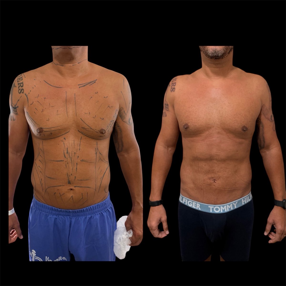 before and after photo