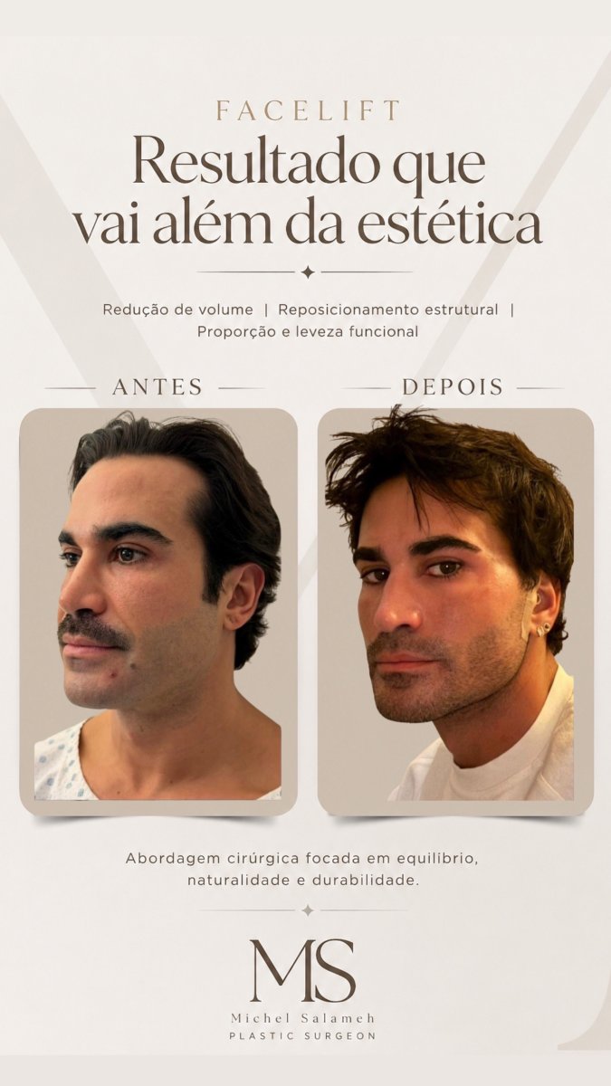 before and after photo