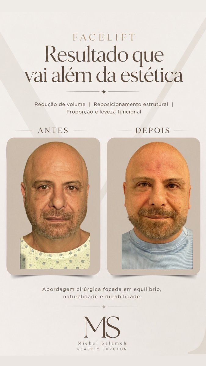 before and after photo