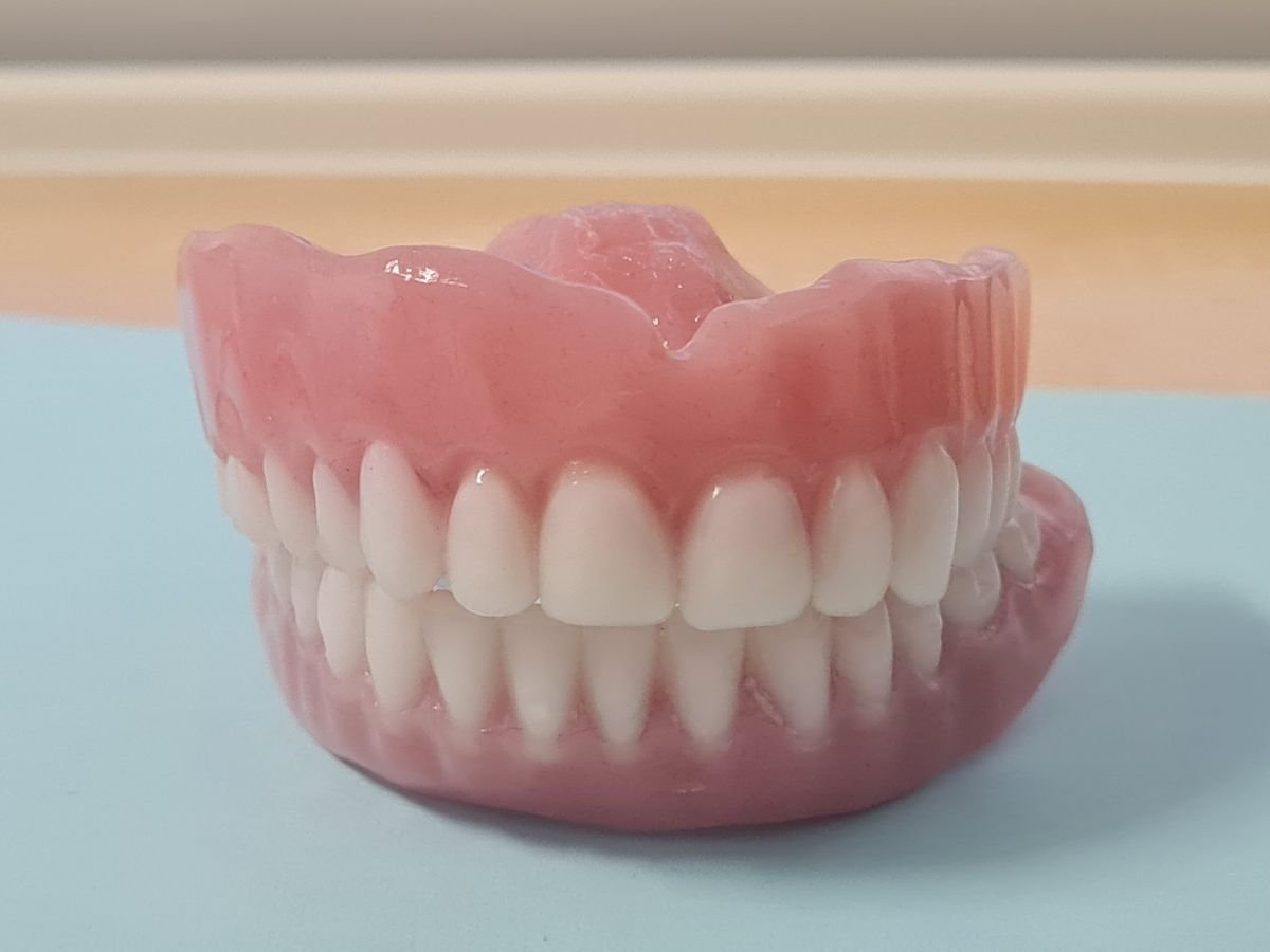 Результат повного протезування в SoftDentalCare Clinic – природні штучні зуби