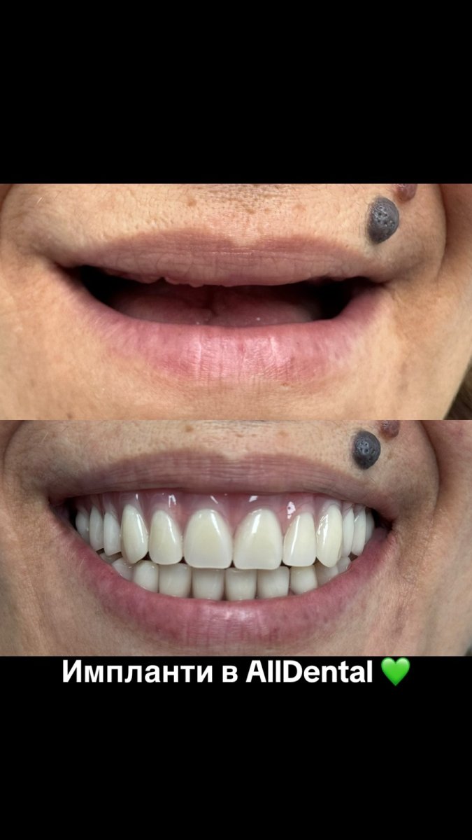 before and after photo
