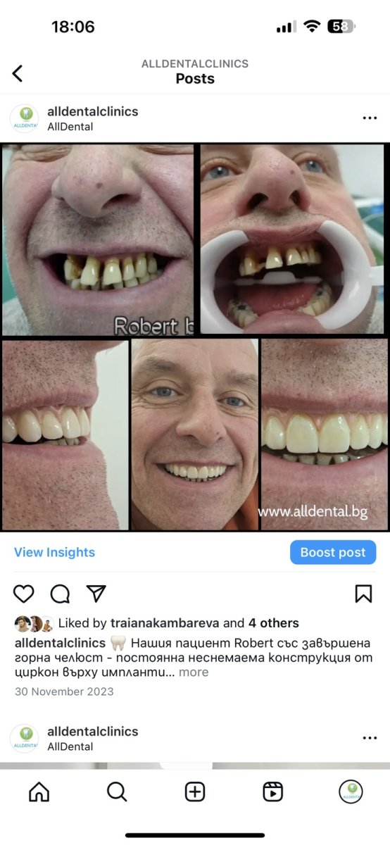 before and after photo