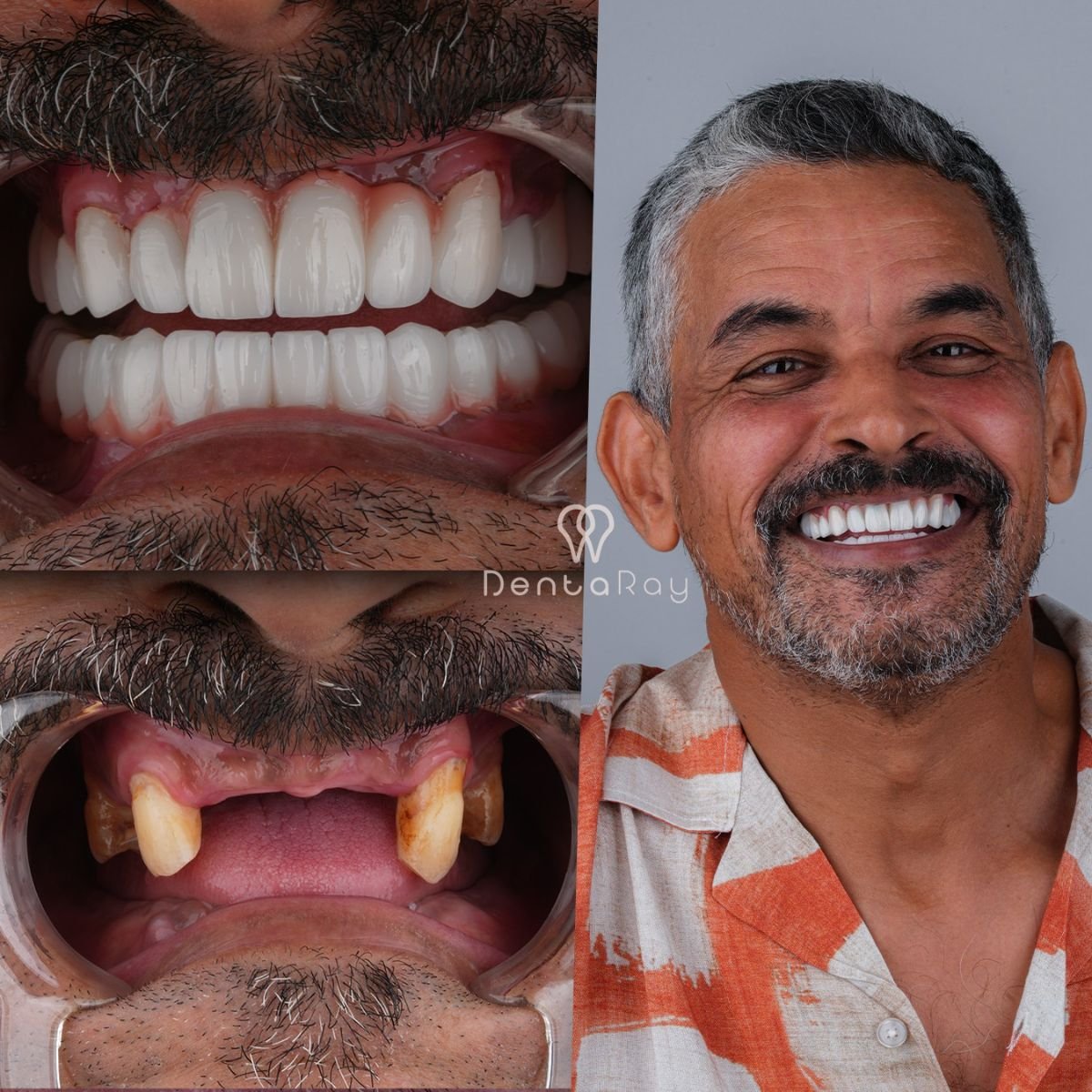 before and after photo