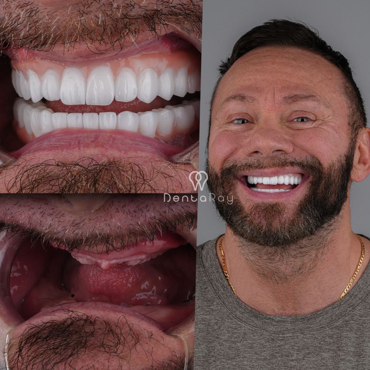 before and after photo