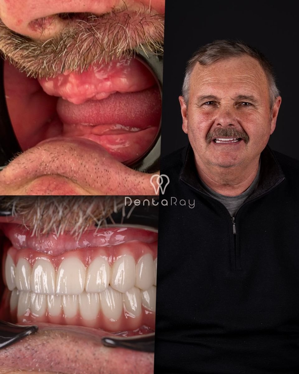 before and after photo