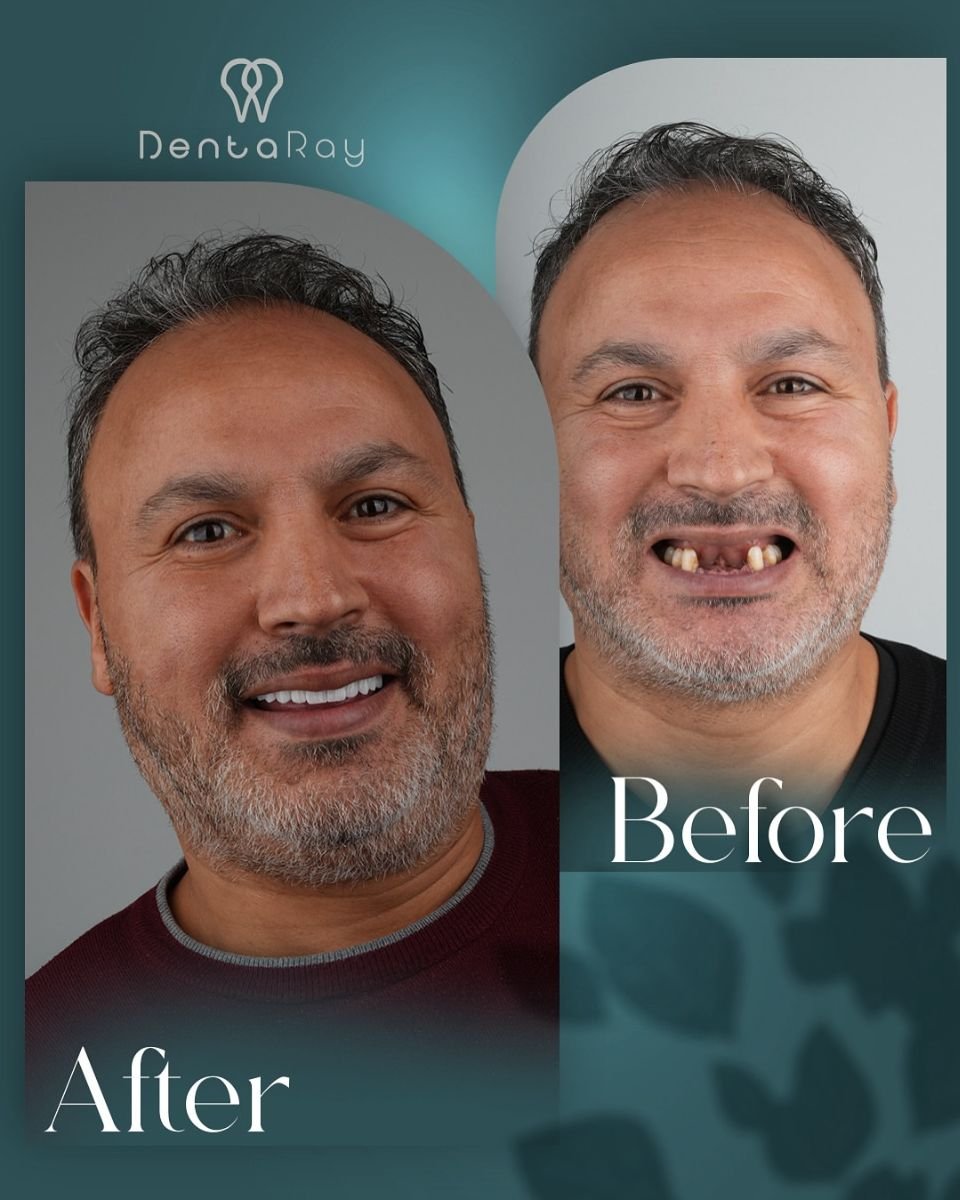 before and after photo