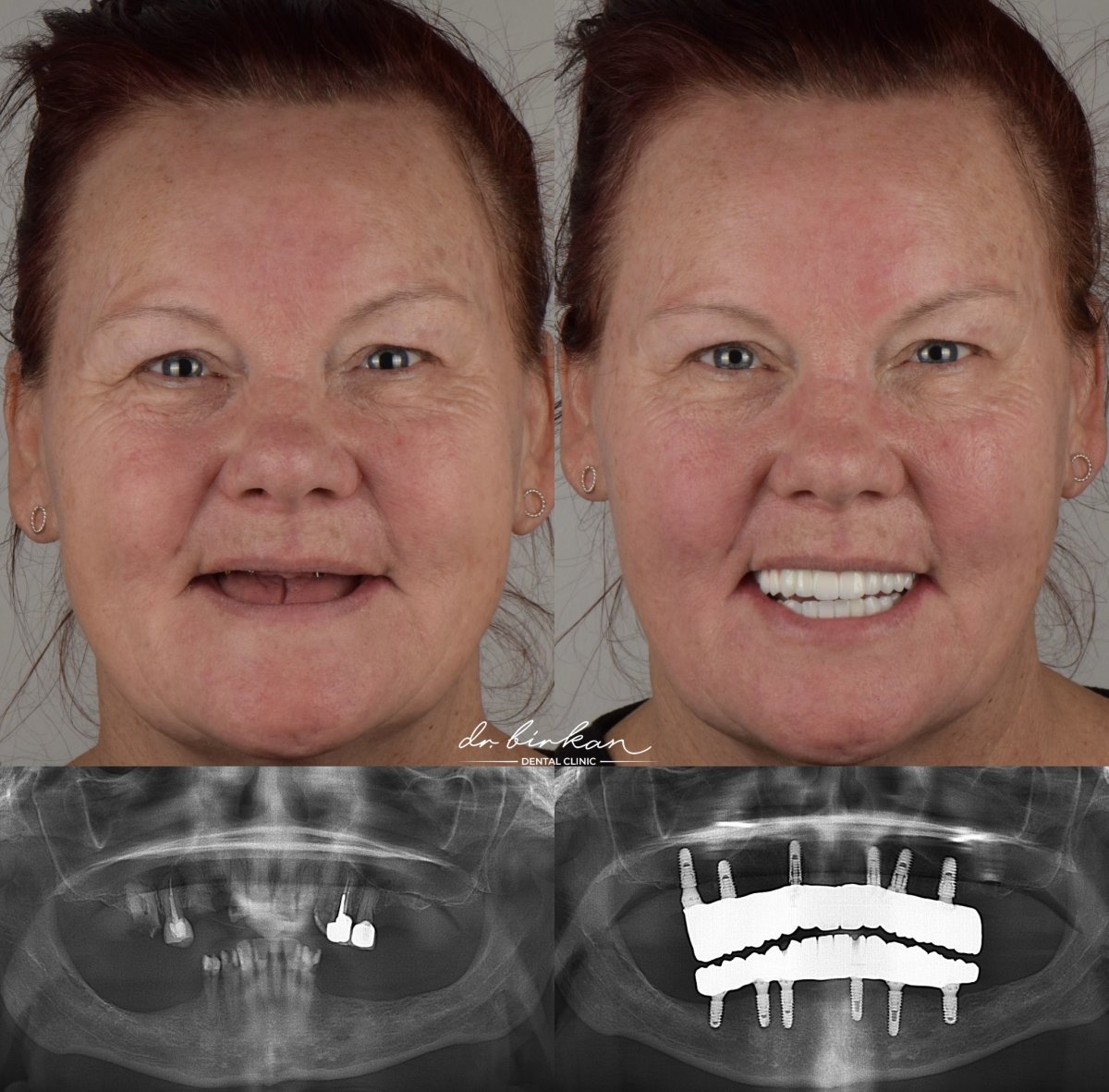 before and after photo