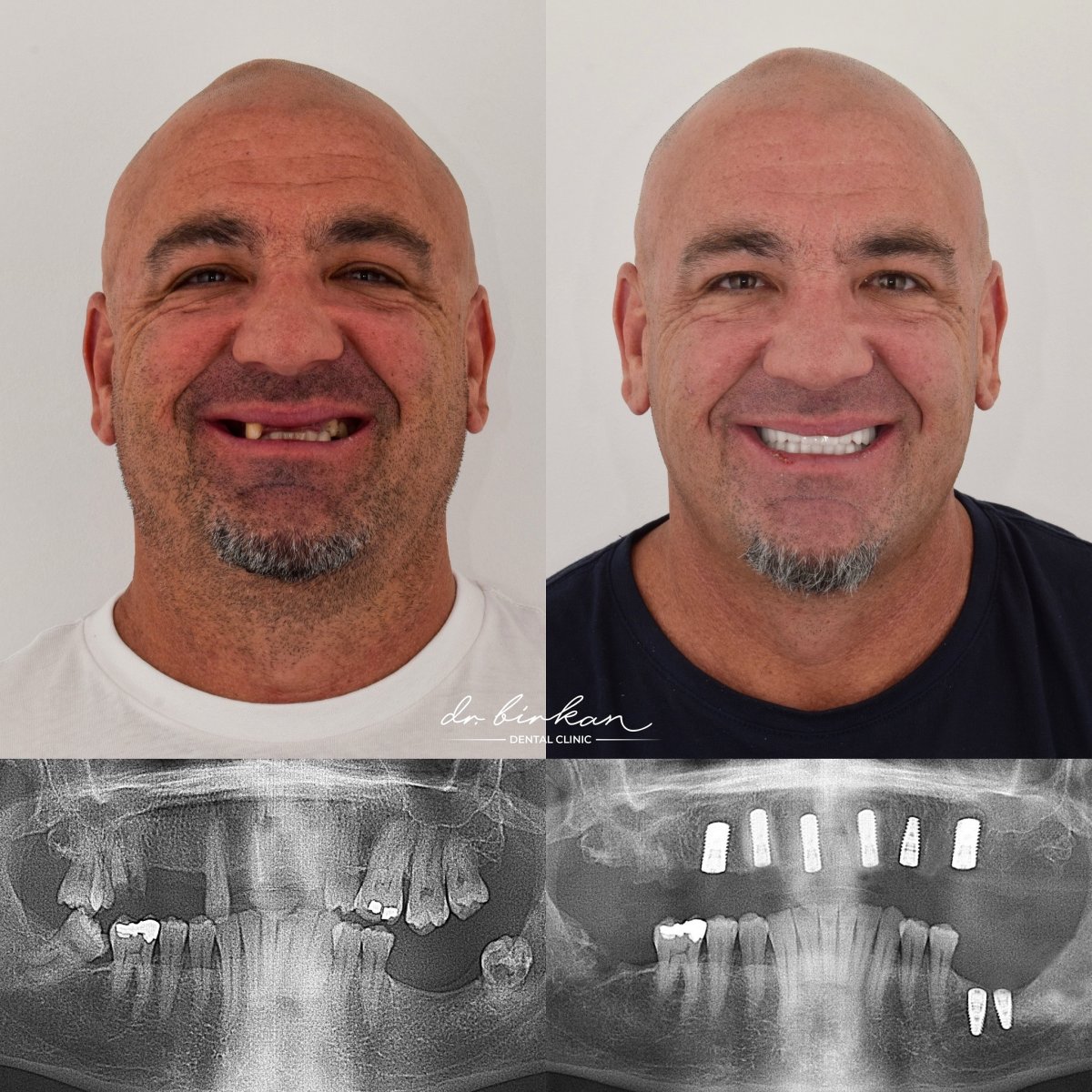 before and after photo