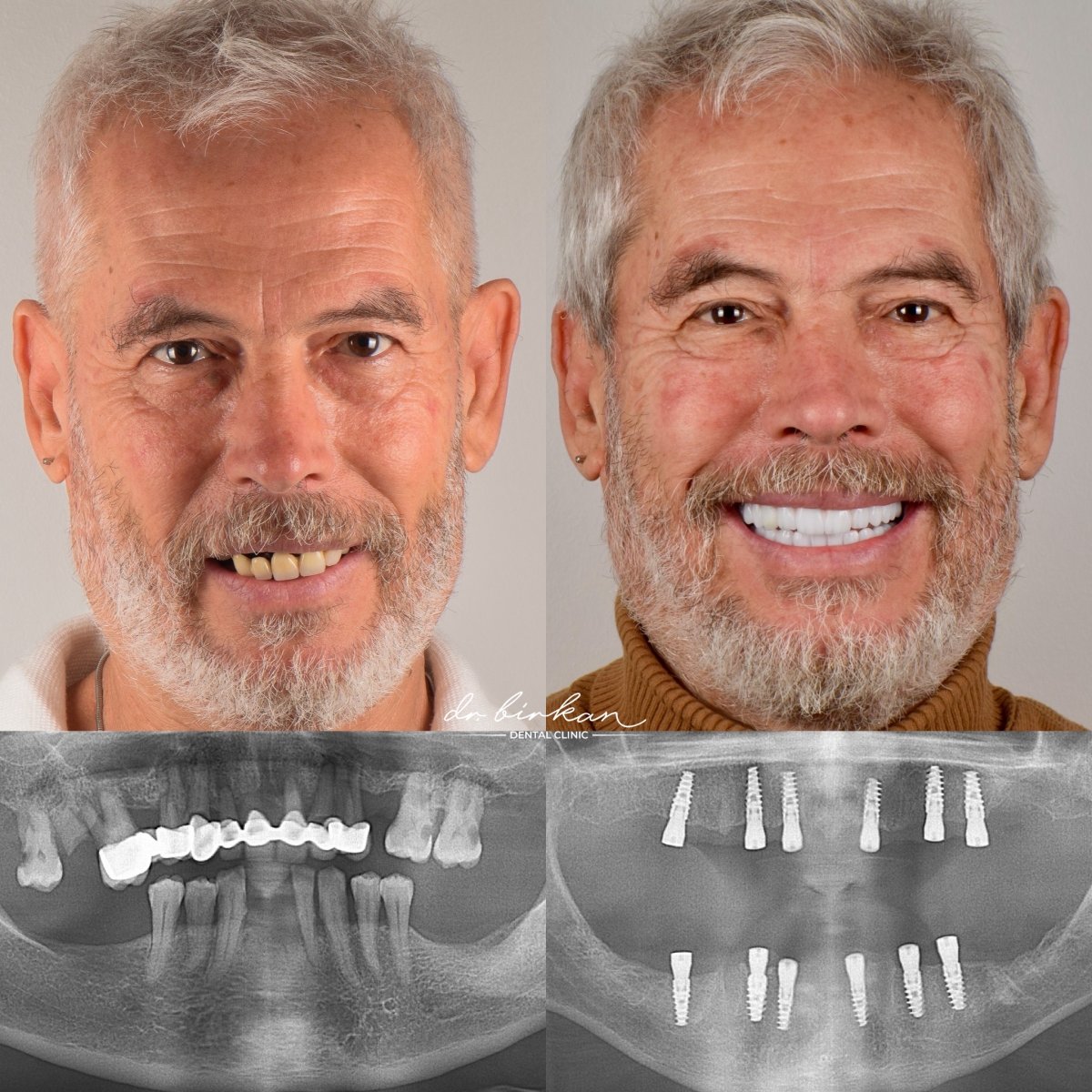 before and after photo