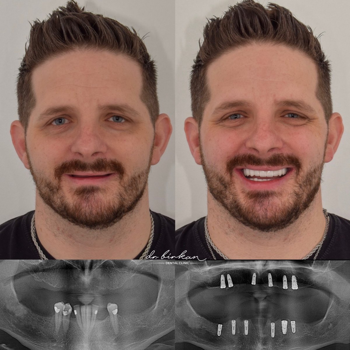 before and after photo