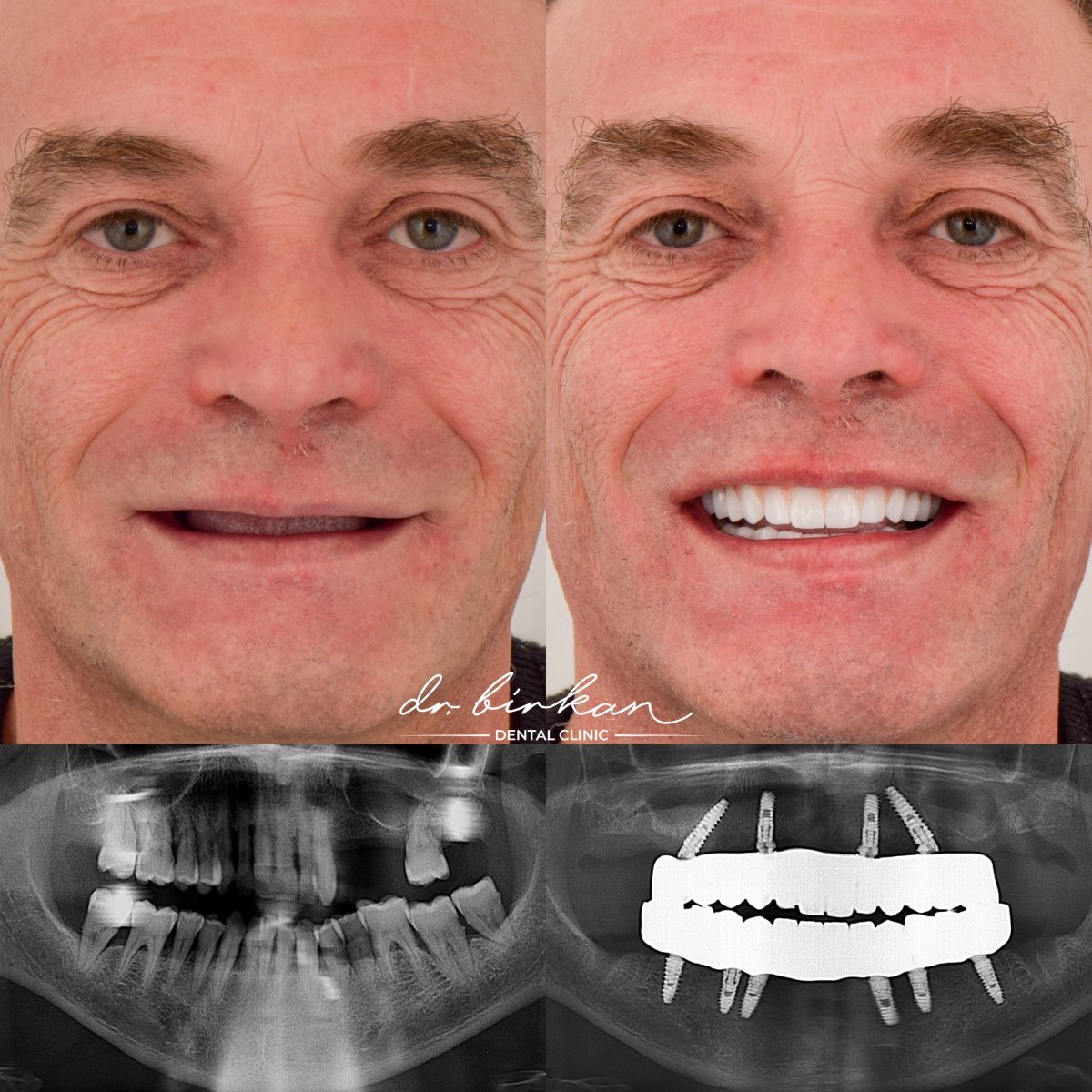 before and after photo