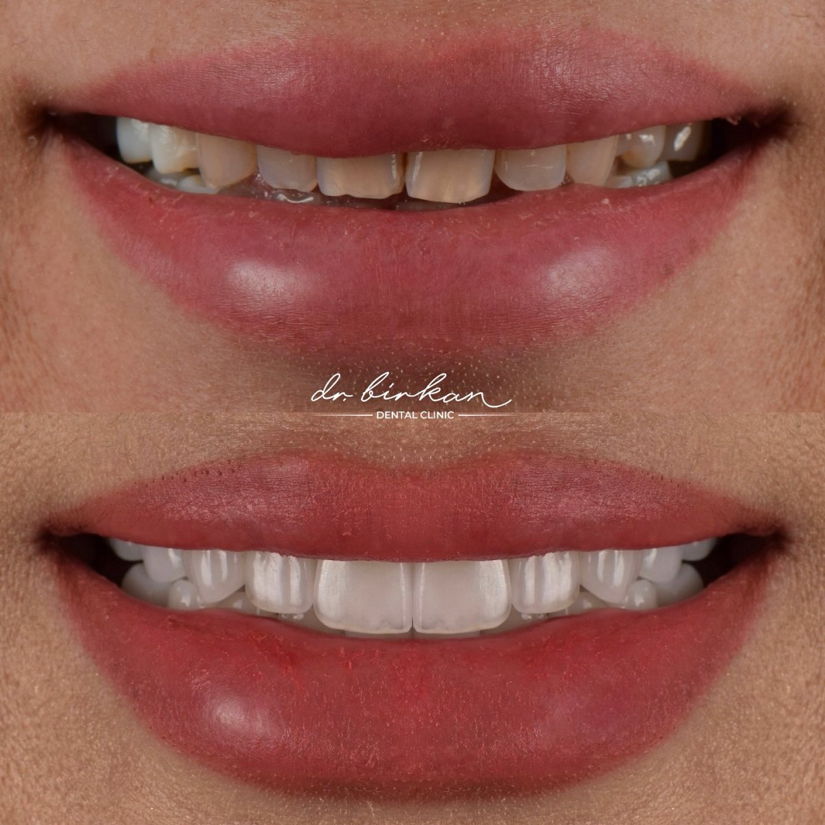 before and after photo