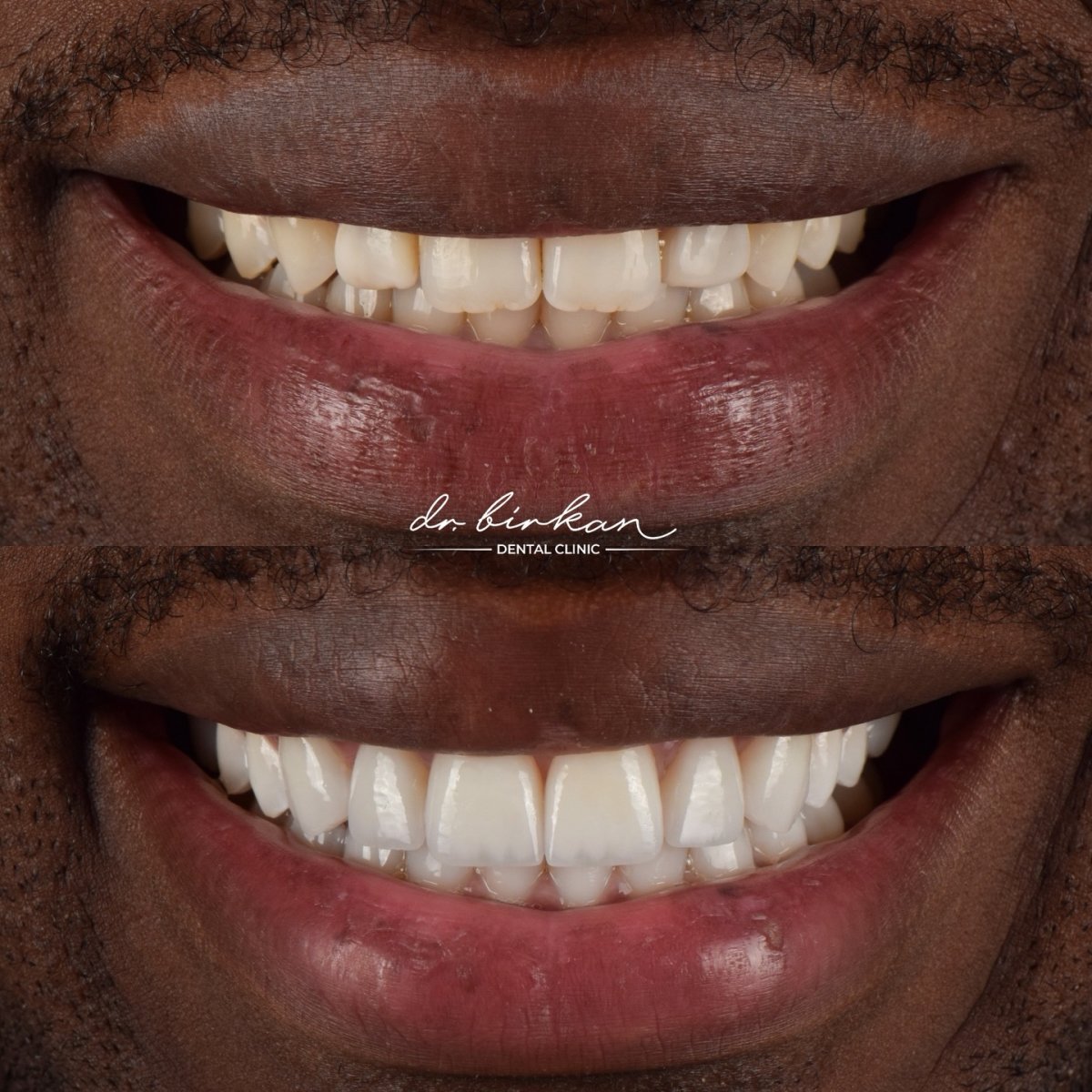 before and after photo