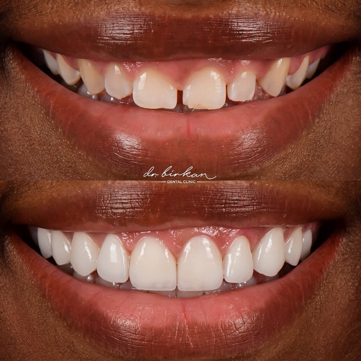 before and after photo