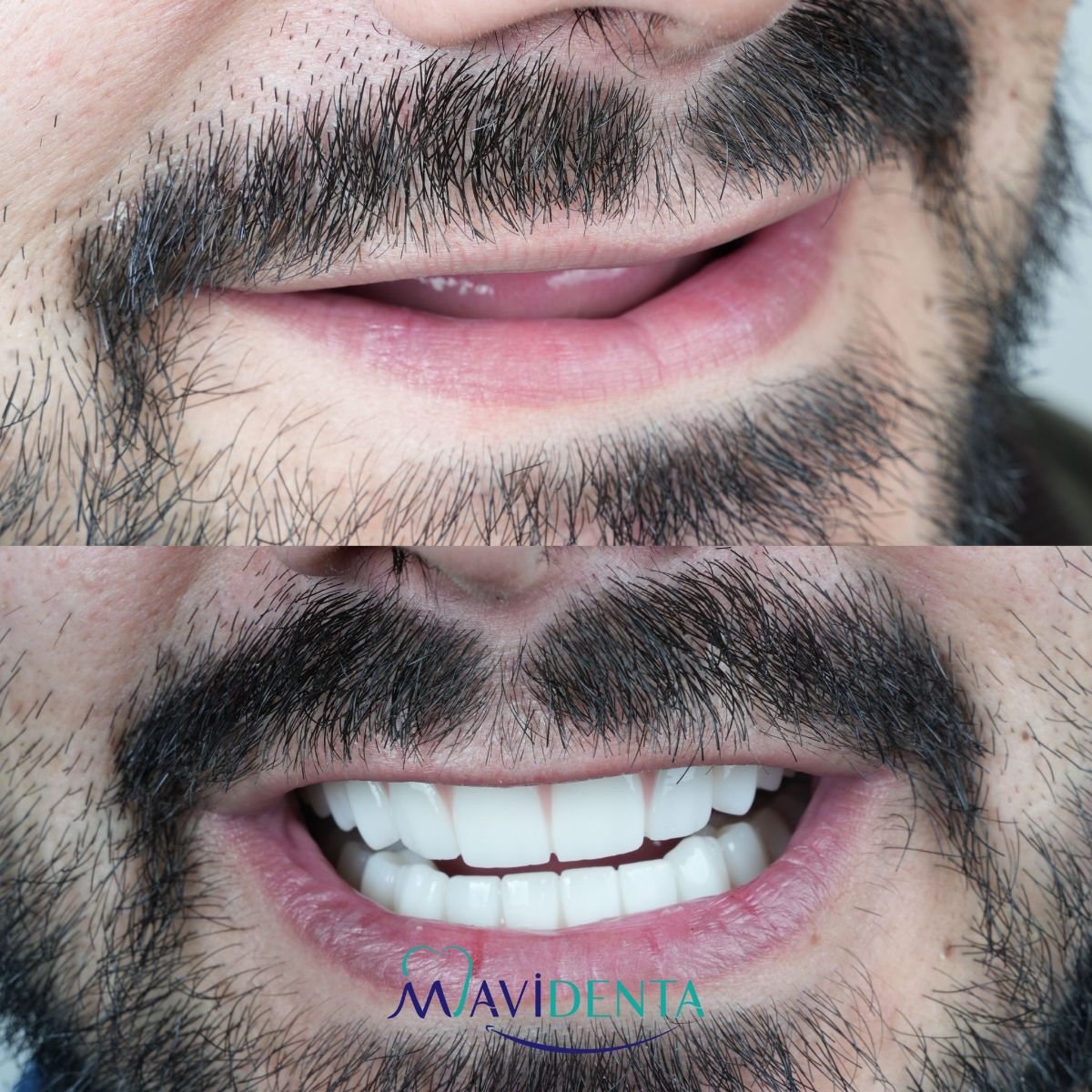 before and after photo