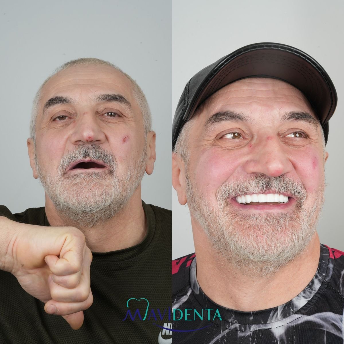 before and after photo