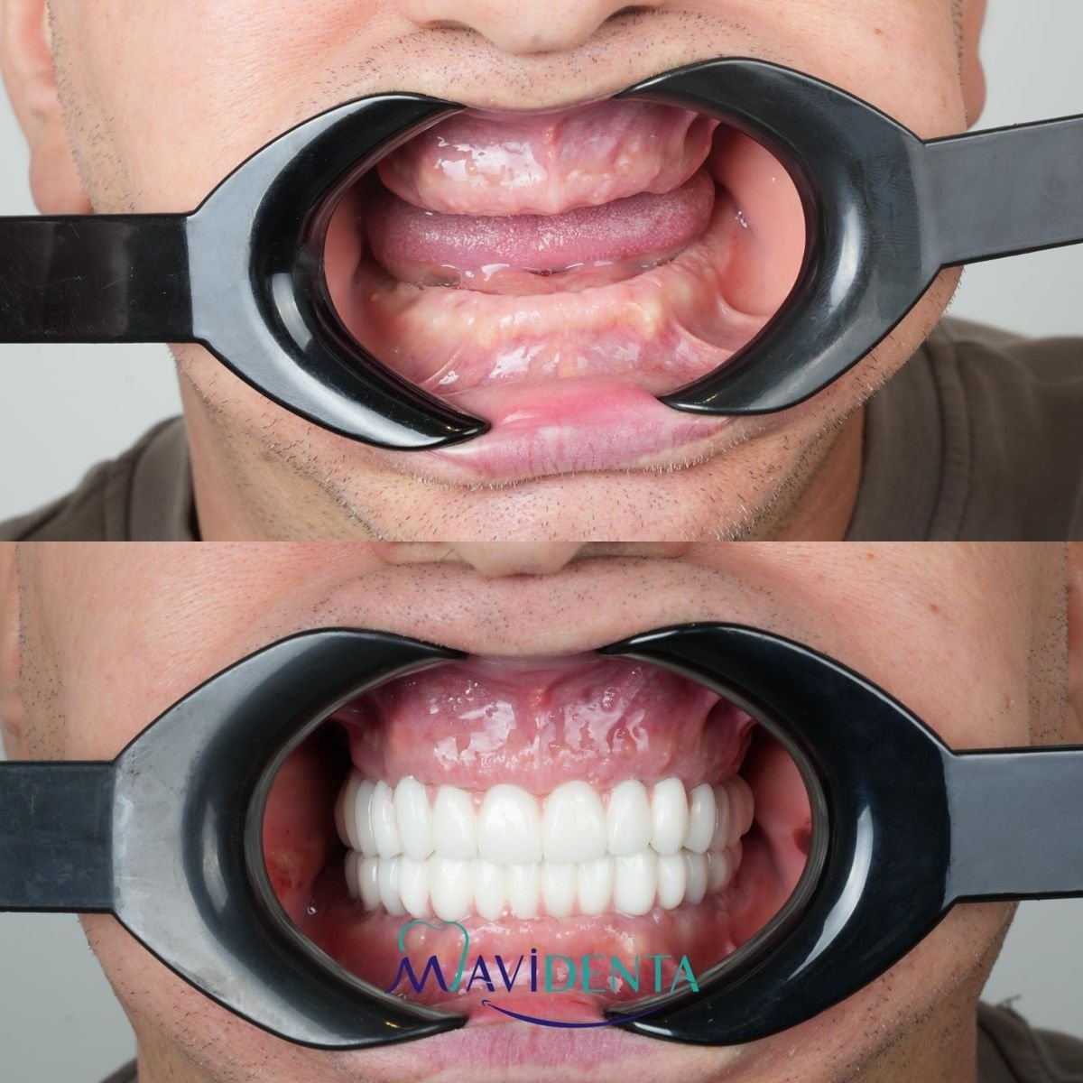 before and after photo