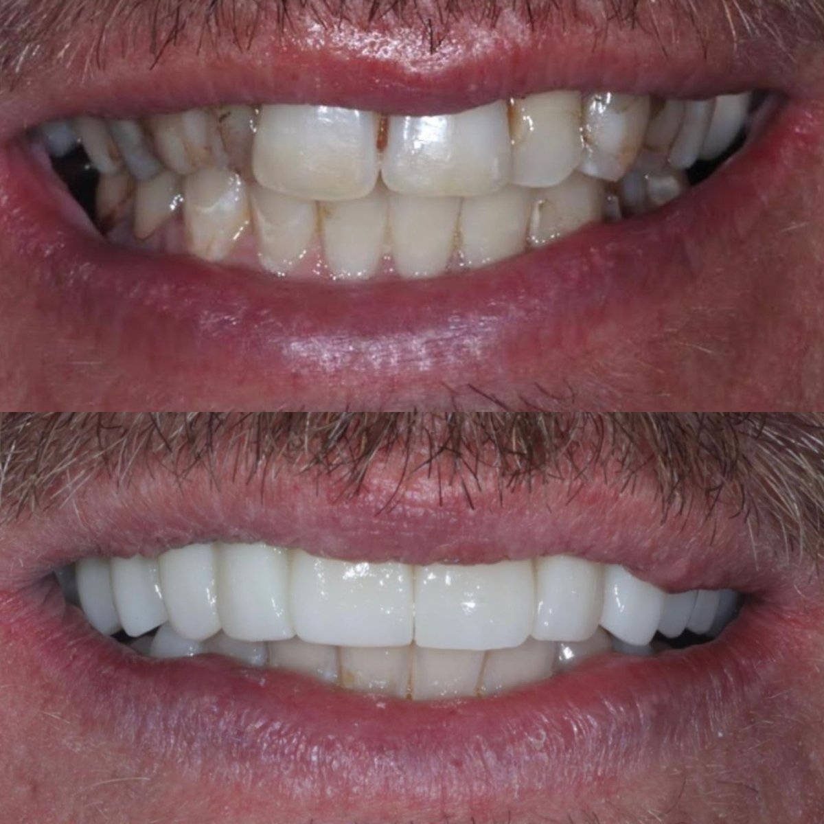 before and after photo
