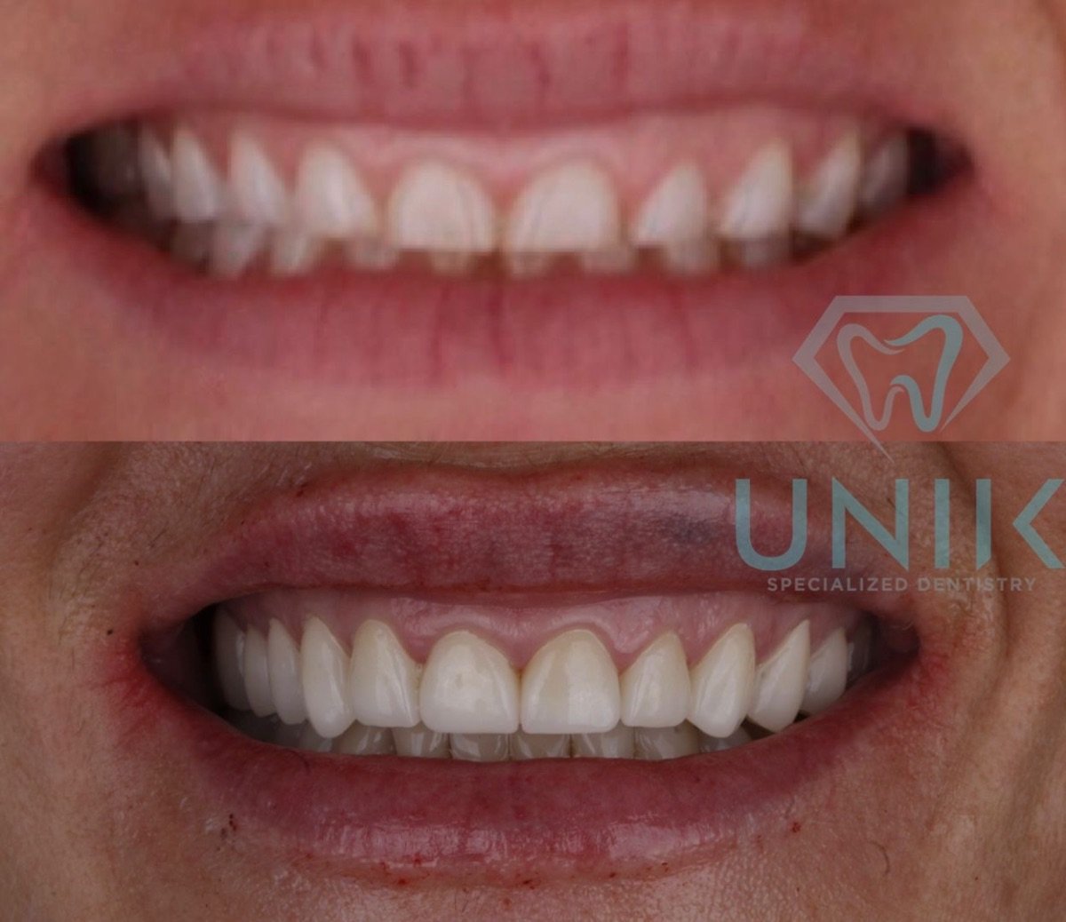 before and after photo