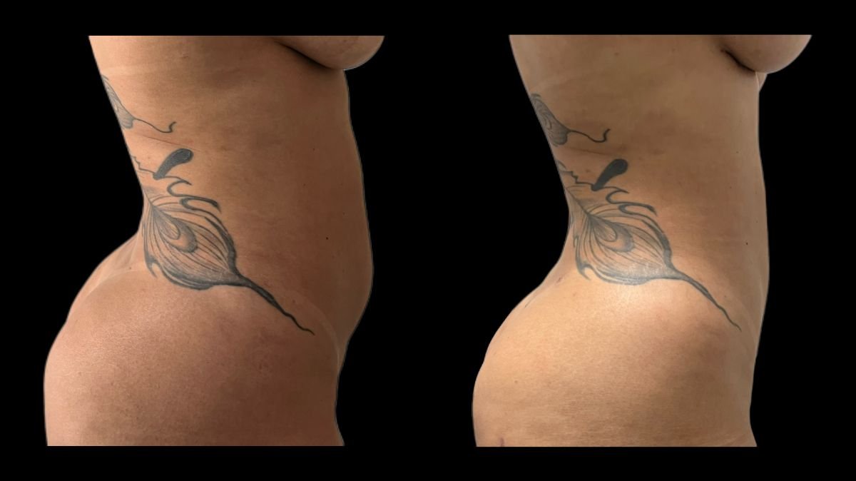 before and after photo