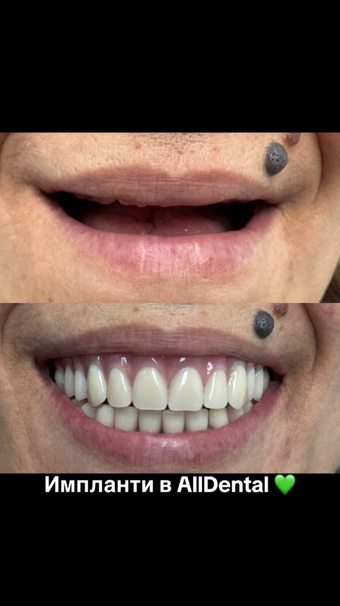 before and after photo