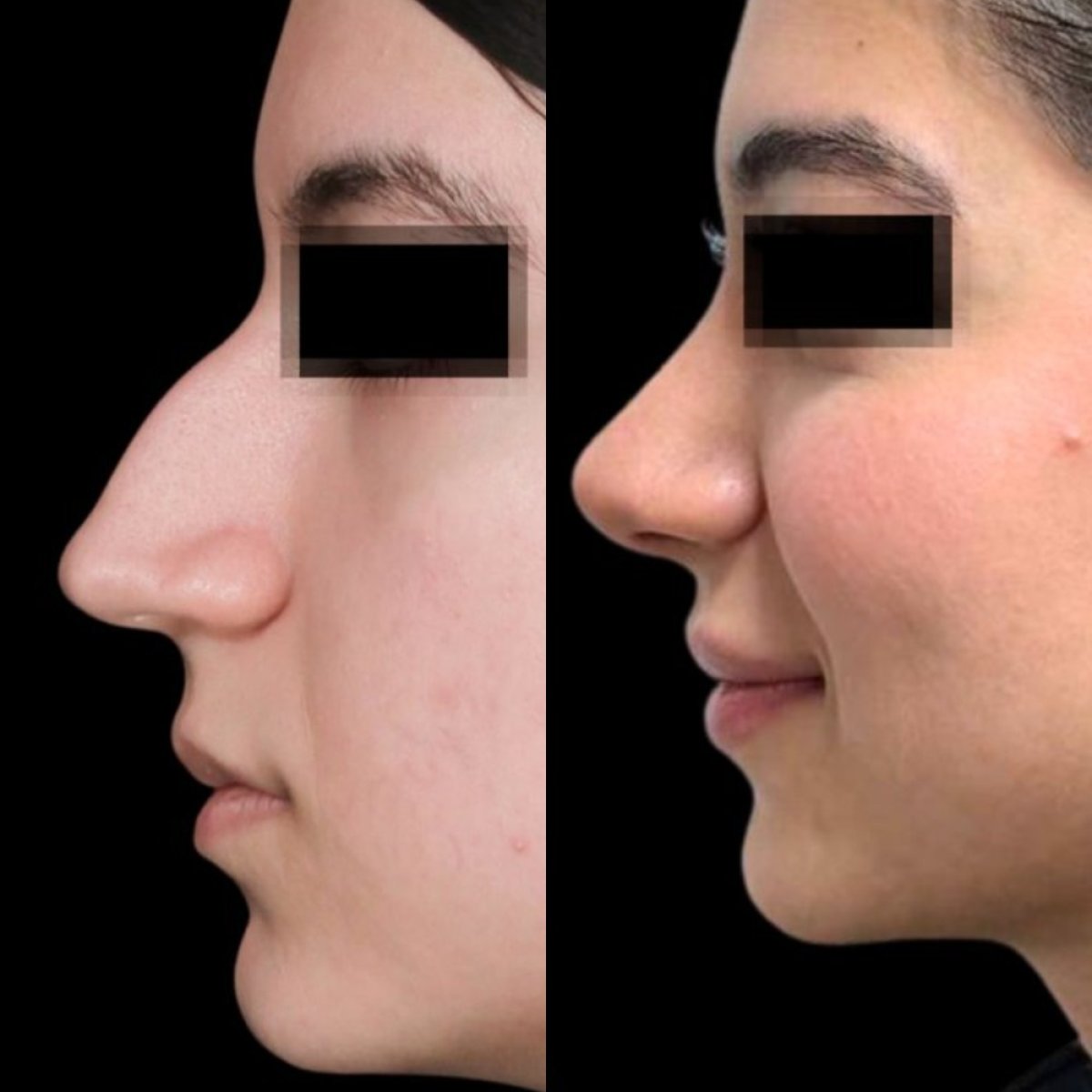 before and after photo