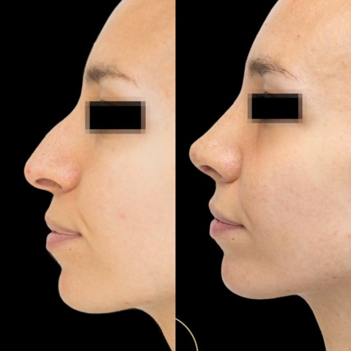 before and after photo
