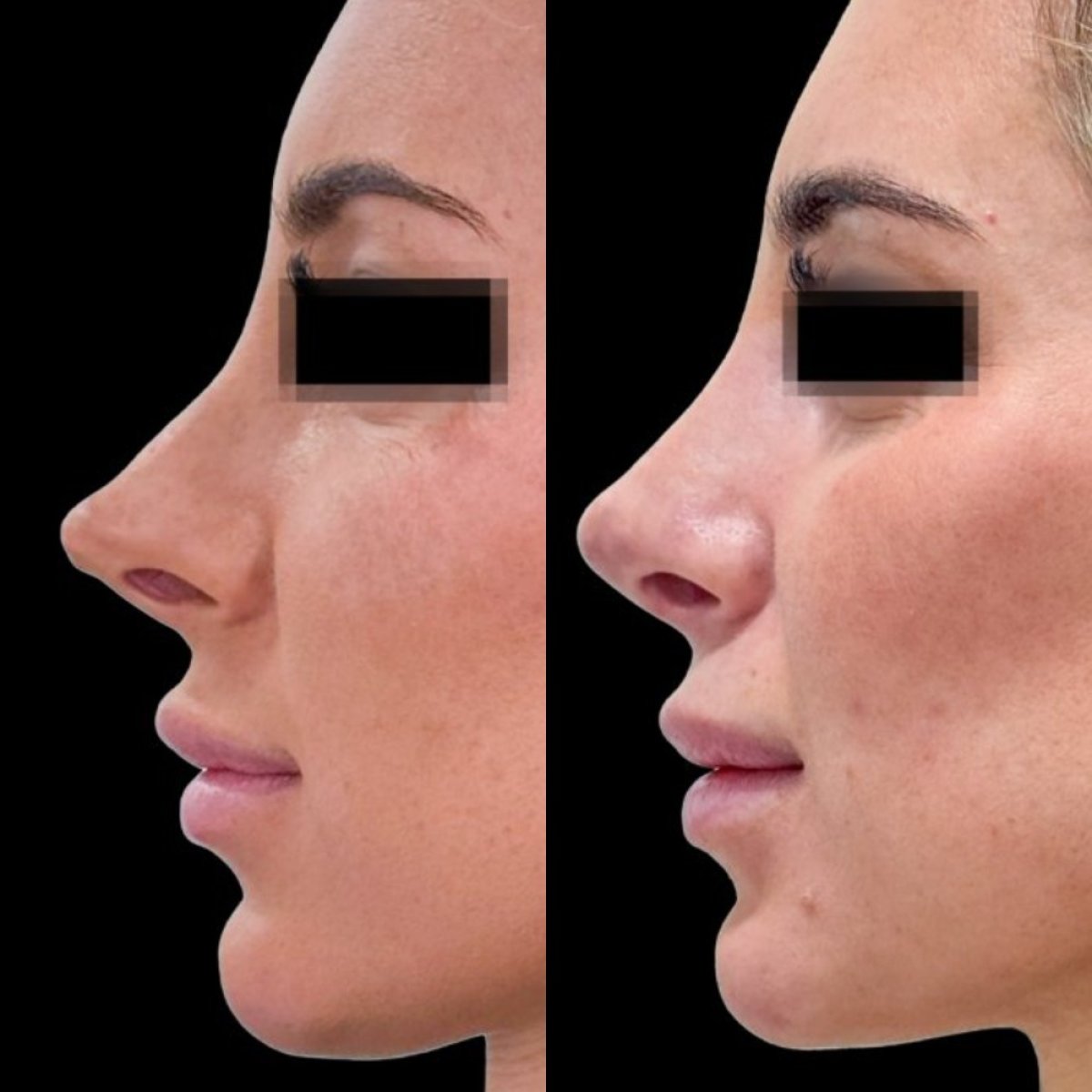 before and after photo