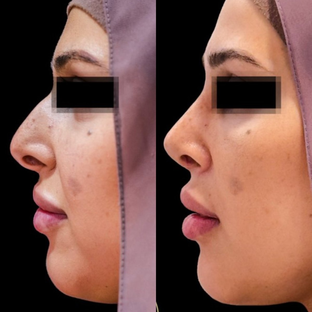 before and after photo