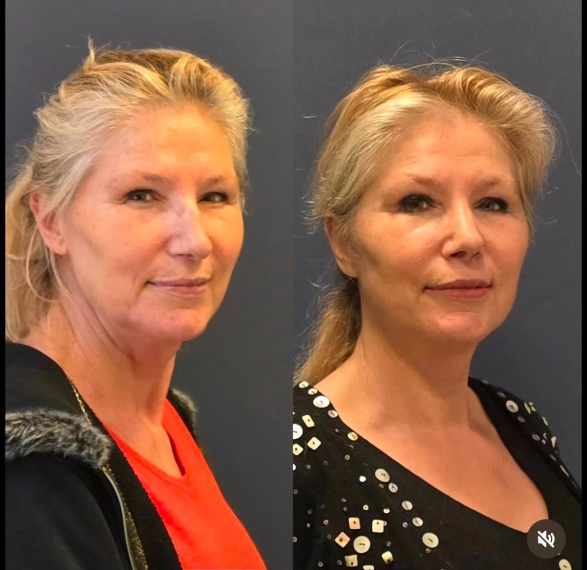 before and after photo