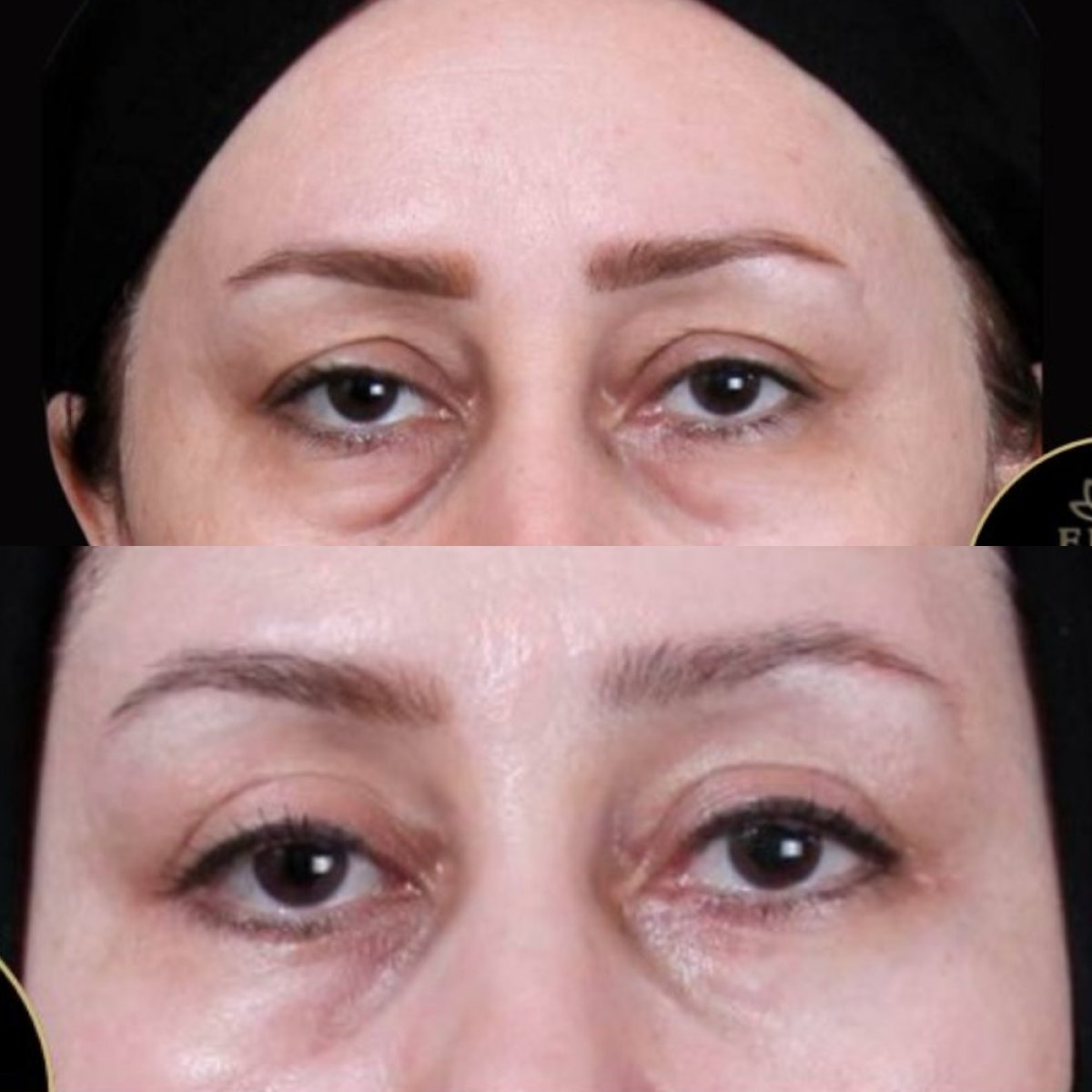 before and after photo
