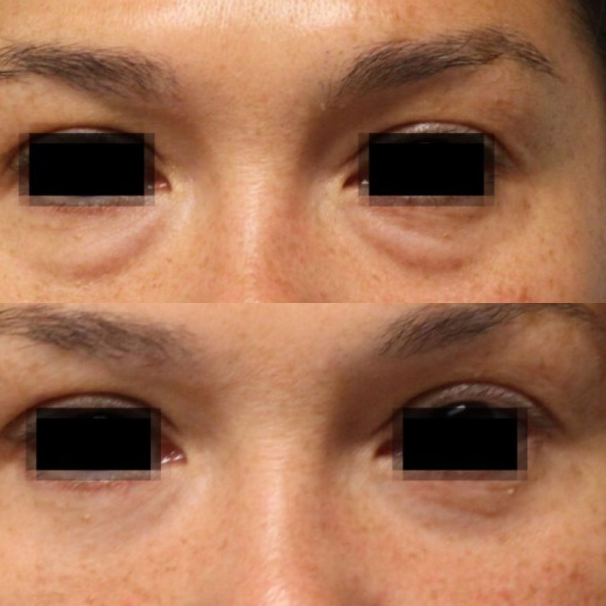 before and after photo