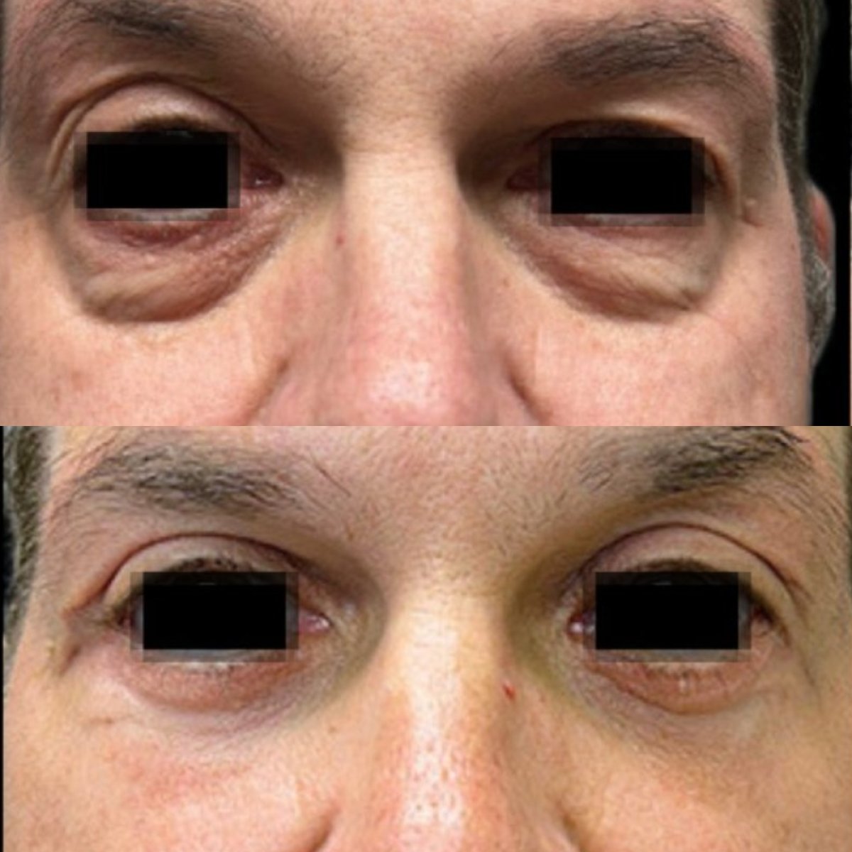 before and after photo