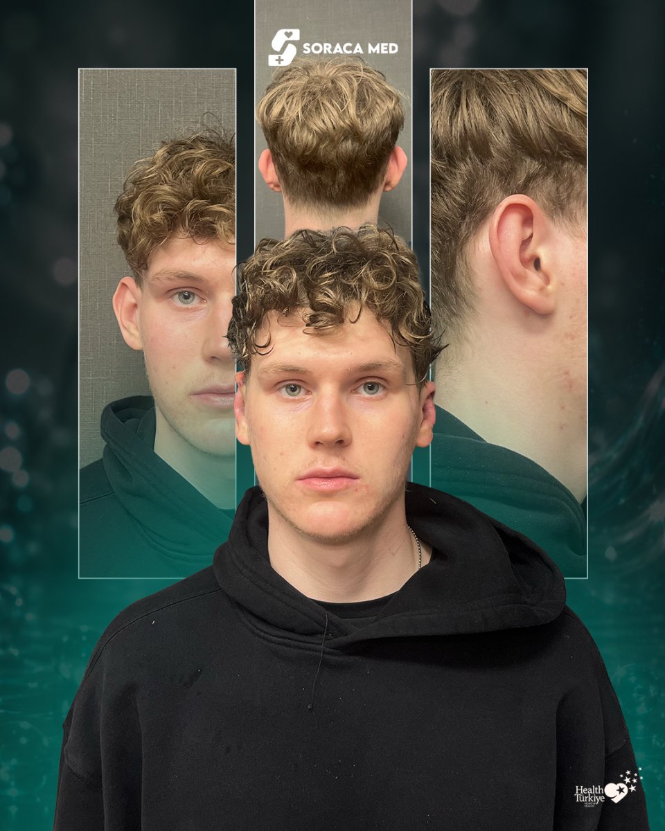 before and after photo