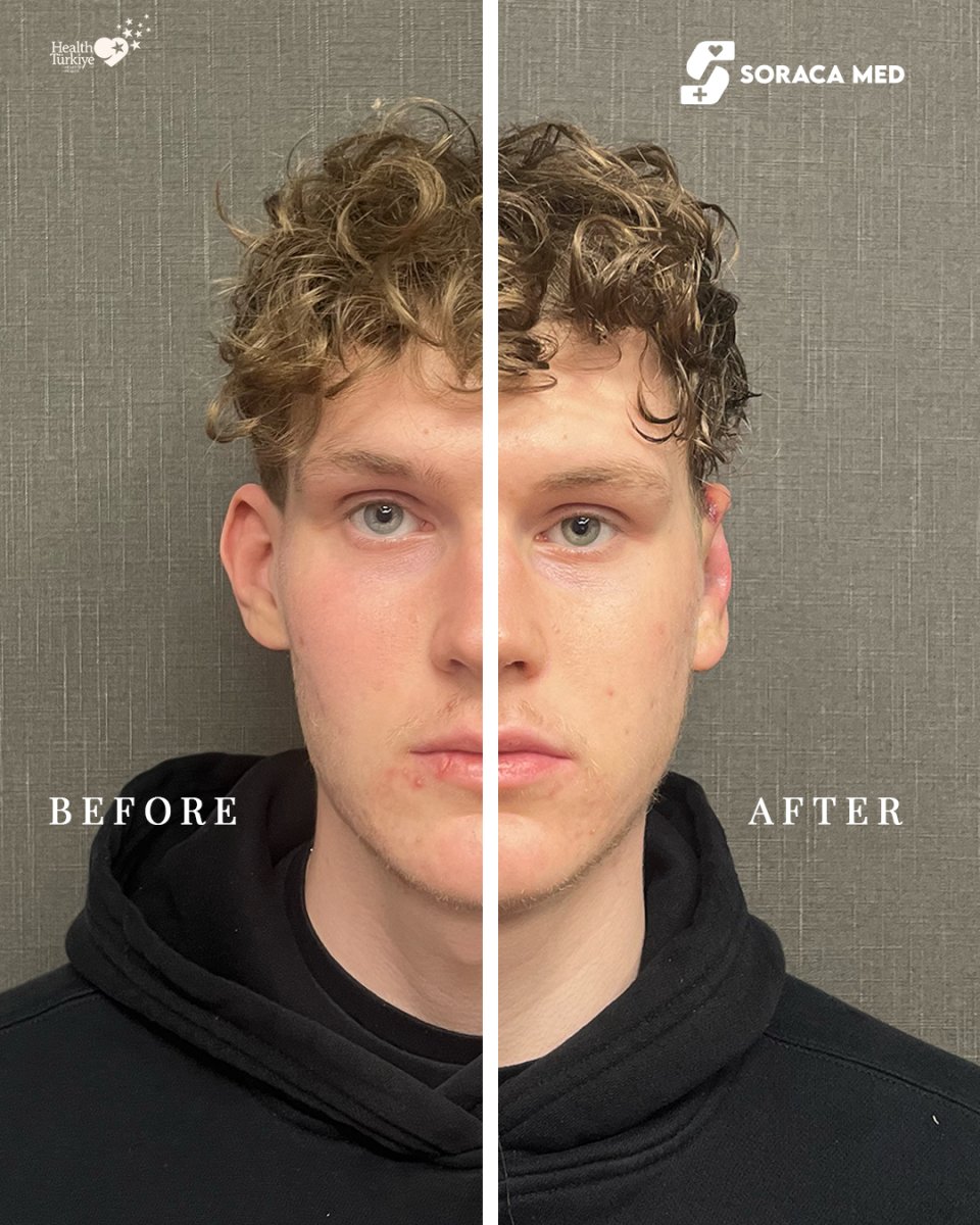 before and after photo