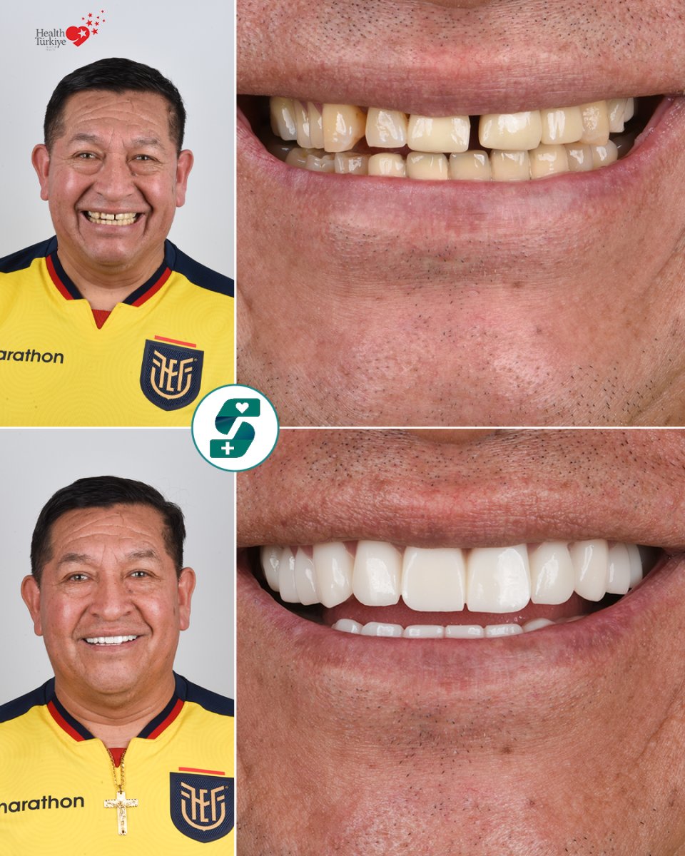 before and after photo