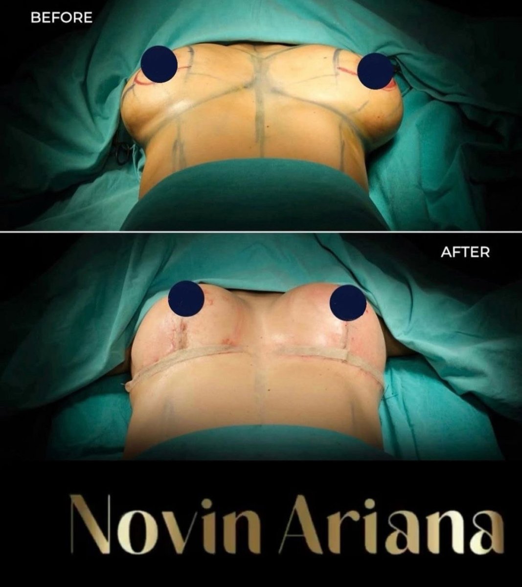 before and after photo