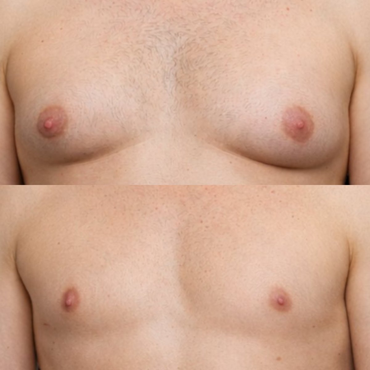 before and after photo