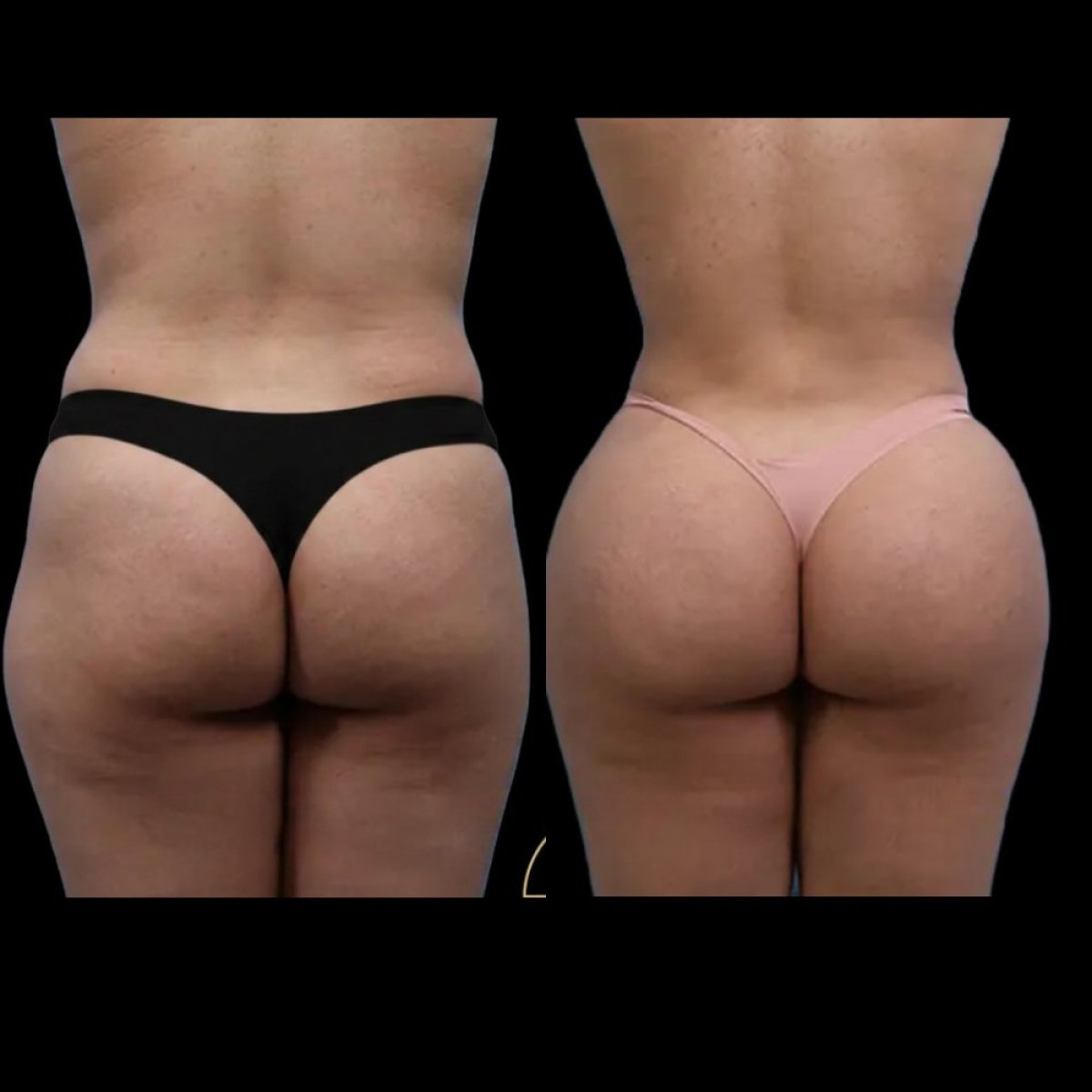 before and after photo