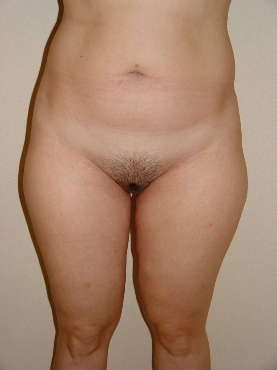 before and after photo